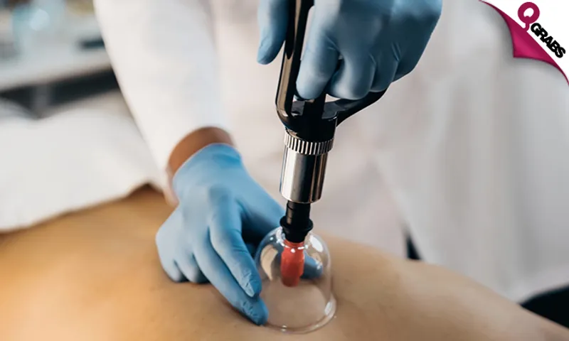 Cupping, Acupressure, Aromatherapy & More!
